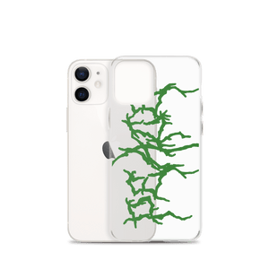 Peace® iPhone Case - Kikillo Club